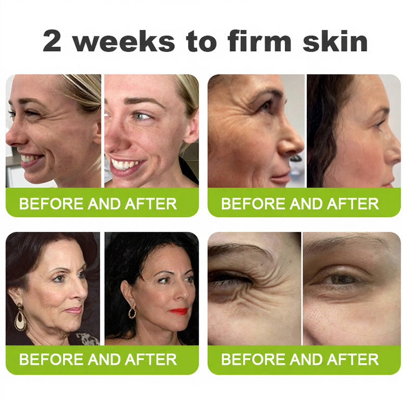 Made and shipped from the USA 💫Skin Tightening & Vita-A Retinol Retinol shot Anti-Wrinkle Firming Tightening cream - Last Day Promotion 70% OFF