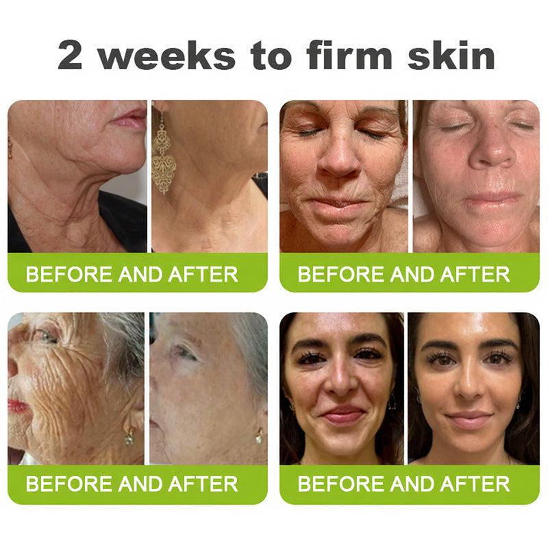 Made and shipped from the USA 💫Skin Tightening & Vita-A Retinol Retinol shot Anti-Wrinkle Firming Tightening cream - Last Day Promotion 70% OFF