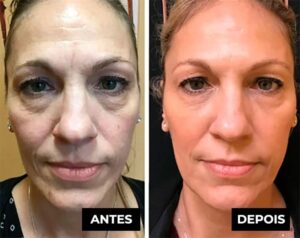 Lifting Firming Cream – Wrinkle Remover in 120 Seconds!