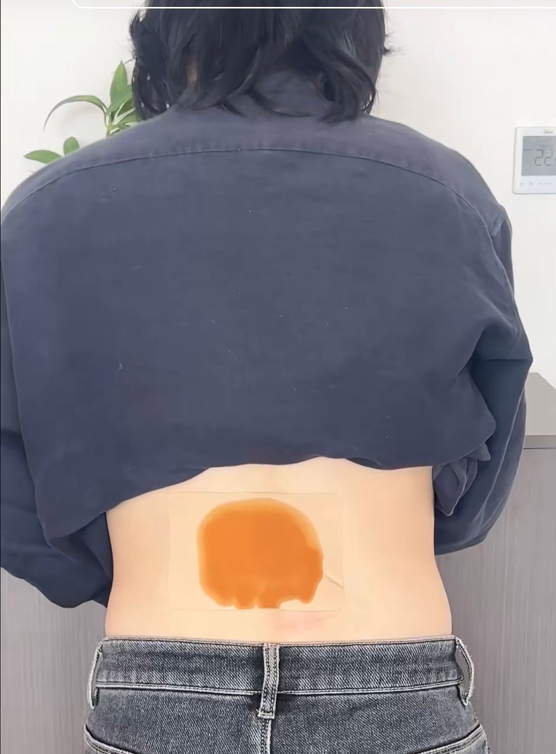 ADHESIVES FOR IMMEDIATE PAIN RELIEF